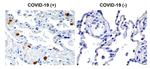 SARS-CoV-2 NSP8 Antibody in Immunohistochemistry (Paraffin) (IHC (P))