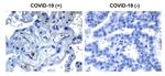 SARS-CoV-2 NSP9 Antibody in Immunohistochemistry (Paraffin) (IHC (P))