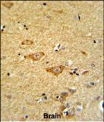 OMD Antibody in Immunohistochemistry (Paraffin) (IHC (P))