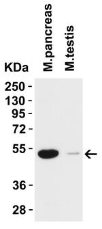 TMPRSS2 Antibody in Western Blot (WB)