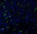 TMPRSS2 Antibody in Immunohistochemistry (PFA fixed) (IHC (PFA))