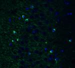 TMPRSS2 Antibody in Immunohistochemistry (PFA fixed) (IHC (PFA))