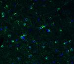 TMPRSS2 Antibody in Immunohistochemistry (PFA fixed) (IHC (PFA))