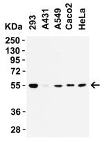 TMPRSS2 Antibody in Western Blot (WB)