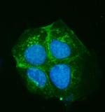 ATP7B Antibody in Immunocytochemistry (ICC/IF)