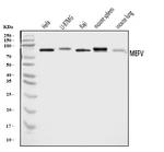 MEFV Antibody in Western Blot (WB)