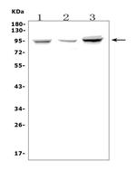 Fibrinogen alpha chain Antibody in Western Blot (WB)