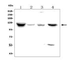 NPR1 Antibody in Western Blot (WB)