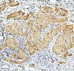 BUBR1 Antibody in Immunohistochemistry (Paraffin) (IHC (P))