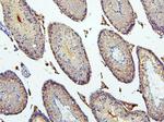 BUBR1 Antibody in Immunohistochemistry (Paraffin) (IHC (P))