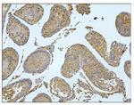 BUBR1 Antibody in Immunohistochemistry (Paraffin) (IHC (P))