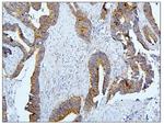 BUBR1 Antibody in Immunohistochemistry (Paraffin) (IHC (P))