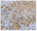 BUBR1 Antibody in Immunohistochemistry (Paraffin) (IHC (P))