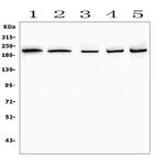 SMARCA2 Antibody in Western Blot (WB)