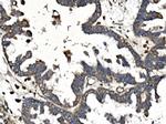 CALM Antibody in Immunohistochemistry (Paraffin) (IHC (P))