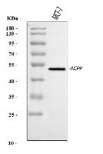 Prostate Specific Acid Phosphatase Antibody in Western Blot (WB)