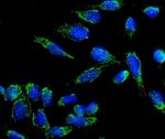 beta-3 Adrenergic Receptor Antibody in Immunocytochemistry (ICC/IF)