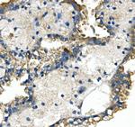 GLUT9 Antibody in Immunohistochemistry (Paraffin) (IHC (P))