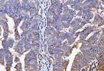 GNB3 Antibody in Immunohistochemistry (Paraffin) (IHC (P))