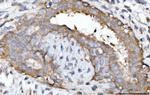 GNB3 Antibody in Immunohistochemistry (Paraffin) (IHC (P))