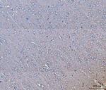 GNB3 Antibody in Immunohistochemistry (Paraffin) (IHC (P))