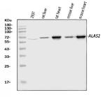 ALAS2 Antibody in Western Blot (WB)