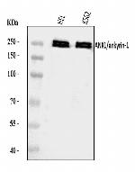 Ankyrin 1 Antibody in Western Blot (WB)