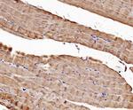 CaV1.1 Antibody in Immunohistochemistry (Paraffin) (IHC (P))