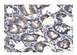 Clathrin Heavy Chain Antibody in Immunohistochemistry (Paraffin) (IHC (P))