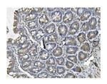 Clathrin Heavy Chain Antibody in Immunohistochemistry (Paraffin) (IHC (P))