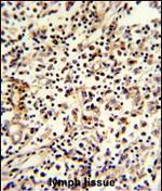 PCM1 Antibody in Immunohistochemistry (Paraffin) (IHC (P))