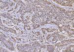 hnRNP U Antibody in Immunohistochemistry (Paraffin) (IHC (P))