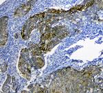 SLC34A2 Antibody in Immunohistochemistry (Paraffin) (IHC (P))