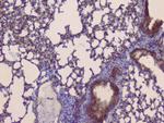 SLC34A2 Antibody in Immunohistochemistry (Paraffin) (IHC (P))