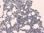 SLC34A2 Antibody in Immunohistochemistry (Paraffin) (IHC (P))
