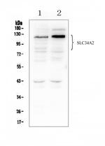 SLC34A2 Antibody in Western Blot (WB)