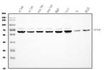 UGT1A3 Antibody in Western Blot (WB)