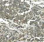 Galectin 2 Antibody in Immunohistochemistry (Paraffin) (IHC (P))