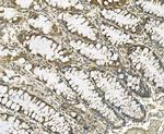 Galectin 2 Antibody in Immunohistochemistry (Paraffin) (IHC (P))