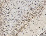 RPL10 Antibody in Immunohistochemistry (Paraffin) (IHC (P))