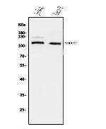 ERAP2 Antibody in Western Blot (WB)