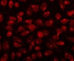 CDK13 Antibody in Immunocytochemistry (ICC/IF)