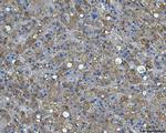 Bi-1 Antibody in Immunohistochemistry (Paraffin) (IHC (P))