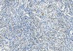 DNAJC6 Antibody in Immunohistochemistry (Paraffin) (IHC (P))