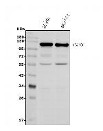 DNAJC6 Antibody in Western Blot (WB)