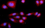 SRP72 Antibody in Immunocytochemistry (ICC/IF)