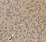 SRP72 Antibody in Immunohistochemistry (Paraffin) (IHC (P))