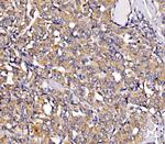 RHOT1 Antibody in Immunohistochemistry (Paraffin) (IHC (P))