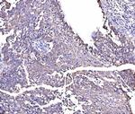 RHOT1 Antibody in Immunohistochemistry (Paraffin) (IHC (P))