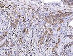 RHOT1 Antibody in Immunohistochemistry (Paraffin) (IHC (P))